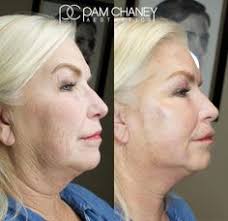 Pam Chaney Aesthetics (alicol0658)