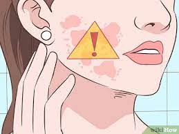 3 Ways To Get Rid Of A Rash On Your Face - Wikihow