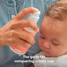 Image result for Cradle Cap