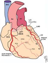 Number of diagonal branches originating from left anterior descending artery. Coronary Arteries Thoracic Key