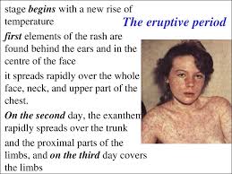 Definition of branny desquamation with photos and pictures, translations, sample usage, and additional links for more information. The Diseases With The Exanthemas Syndromes Prezentaciya Onlajn