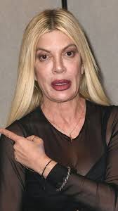 THEY LIED! Celebs Who Secretly Used Ozempic — Until They Got Caught  #celebrity #ozempic