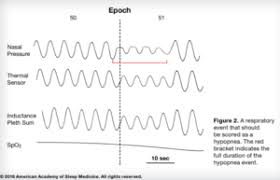 What Do Ahi Rera Arousal And Rdi Mean Advanced Sleep