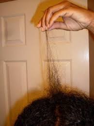Find bald spots growing no matter what your try? Black Hair Thinning At Crown The Crown Breakage Mystery Unlocked Natural Hair Styles Hair Thinning At Crown Black Hair Breakage
