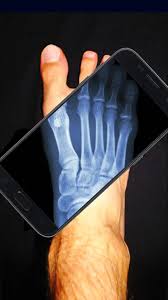 The program is compatible with all models of mobile phones that are equipped with a video ca Xray Body Scanner Simulator 3 4 Apk App Android Apk App Gallery