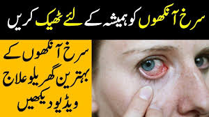 Best Effective Home Remedies For Red Eyes In Urdu Home Remedies Tired Eyes Remedies