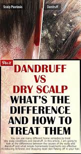 Then, i found sensitive scalp developer. Dandruff Versus Dry Scalp Find The Differences And The Best Treatments In 2021 Dry Scalp Dry Scalp Remedy Itchy Dry Scalp Remedy