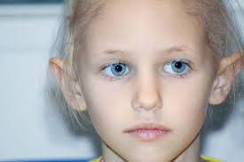 ¿cuáles son los signos y los síntomas del retinoblastoma? Retinoblastoma Sintomas Causas E Tratamento Melhor Com Saude