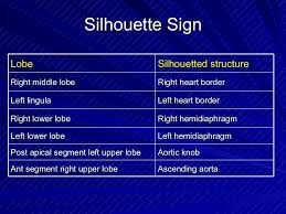 Silhouette Sign Lobe Silhouetted Structure Right Middle Lobe Right Heart Border Left Lingula Left Heart Border Rig Silhouette Sign Intensive Care Gross Anatomy