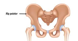 Image result for Hip Apophysitis