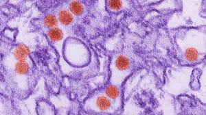 Allerdings würden für den vektorimpfstoff mehr verdachtsfälle von nebenwirkungen gemeldet als. Zikavirus Vektorimpfstoff Schutzt Im Mausmodell