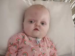 Scots tot with rare disorder wears rainbows to thank NHS staff looking  after her in hospital