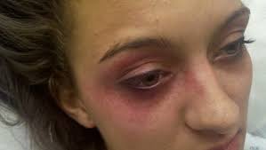 Former Kickapoo student injured at school event sues SPS