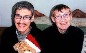 Brothers Diagnosed With Benjamin Button Age Reversing Disease