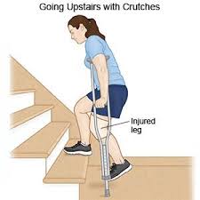 Crutches Going Upstairs With Crutches Acl Tear Recovery Allina Health Crutches