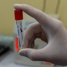 Find out how each test is performed and how accurate they are. Covid 19 Test Fur Unternehmen Schnelltest Fur Mitarbeiter