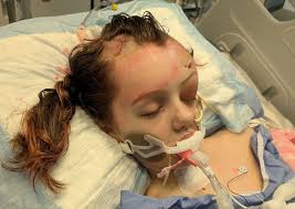 Maya Gebala shows response, faces emergency surgery - CHVNRadio: Southern  Manitoba's hub for local and Christian news, and adult contemporary  Christian programming.