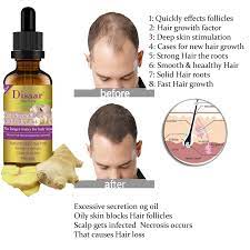 Hair Growth Oil Fast Powerful Disaar Fresh Deal Hair Growth Oil Hair Growth Hair Care Oil