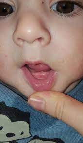 Während die einen babys bereits mit einem zahn auf die welt kommen, bekommen andere erst nach dem ersten. Erster Zahn Bzw Zahne Forum Fur Juli 2016 Mamis