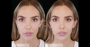 Dubrow couples his outstanding professional credentials and ethics with a personalized approach to patient care and a keen eye for aesthetic beauty. What Are Chin Fillers And Why Should I Request Them