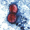 Cryptosporidium parvum is a coccidian parasite that affects the intestinal and respiratory epithelium of vertebrates. 1