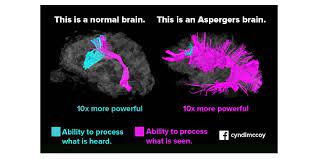 Perceptual inconstancy in early infantile autism // archives of general psychiatry. Asperger Syndrome Reflection Www Fuelcellstore Com