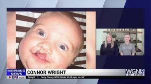 WGN Morning News interviews Connor