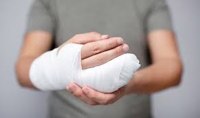 Image result for Hand Injury