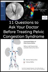 Questions To Ask Your Doctor Before Treating Pelvic Congestion Syndrome