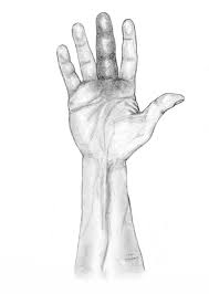 Image result for phlegmon of hand)