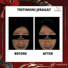 Sebab jarang taw kita buat harga pakej macam ni. Hannan Medispa Parit Buntar Hm Paritbuntar Twitter