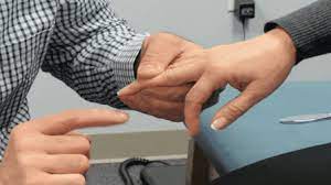 The test for hoffman's sign involves tapping the nail on the third or forth finger. Positive Hoffmann S Sign Finger Flexor Reflex In Grepmed