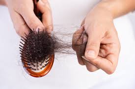 Unfortunately, while a vitamin deficiency can cause hair loss, it is usually not the main reason for thinning hair. 19 Causes Of Hair Loss How To Treat It Health Com
