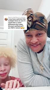 Who Were The White Twins in The Topia Twins Music Video