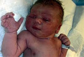 Jacob Abraham Obituary