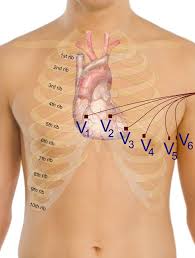 12 lead ecg placement adinstruments