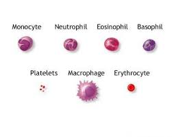 Leucemia mieloida acuta si cronica 1. Poze Medicale Leucemia Mieloida Acuta La Adulti
