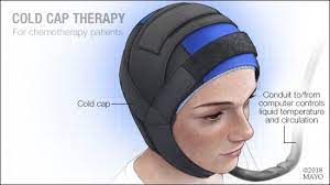 Which chemotherapy drugs cause hair loss? Scalp Cooling Therapy Mayo Clinic Health System