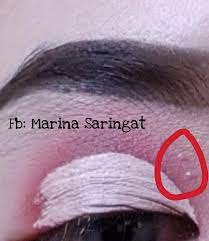 Jumlah ini bisa diukur melalui tes darah. Wanita Ini Kongsi Cara Mudah Hilangkan Biji Kolesterol Di Wajah Guna Dua Bahan Ni Je Masalah Setel Hijabista