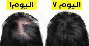 تجربتي الناجحة في تكثيف شعري في اقل من اسبوع