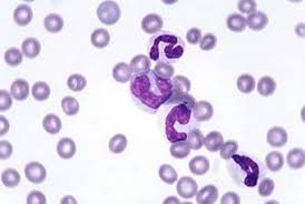 La causa son las enfermedades autoinmunitarias, como el lupus y la artritis reumatoide. Neutropenia Inmunomediada Primaria En Perros Axon Comunicacion Expertos En Soluciones Integrales Y Formacion En Veterinaria