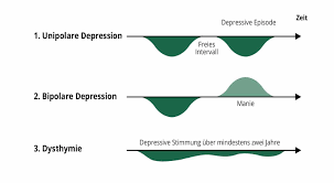 A person with depression may not always seem sad to others. Depression Anzeichen Und Ursachen Klinik Friedenweiler