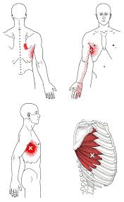 Pin On Symptoms