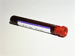 More research is needed before the panels of 10 to 20 biomarkers that orstroff's research found for each of these cancers can be done by. Experimental Blood Test Detects Cancer Up To Four Years Before Symptoms Appear Scientific American