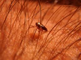 How to get rid of fleas on humans skin. Sand Flea Disease Is Neglected What Needs To Be Done