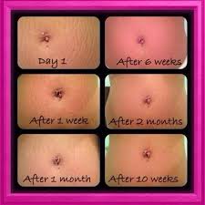 Bio Oil Before And After Old Scars Ds Exclusive Best Way To Get Rid Of Stretch Marks For Good No Matter How Old They Are Oil For Stretch Marks Rodan And Fields Rodan And Fields Consultant