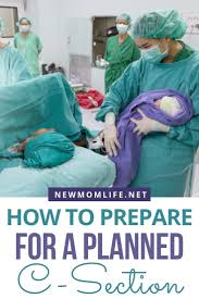 Preparing For A C Section Ultimate Guide C Section How To Plan Gentle Parenting