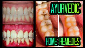 171 Easy Ayurvedic Remedies For Healthy Teeth Gums Youtube Ayurvedic Remedies Healthy Teeth Ayurvedic Home Remedies
