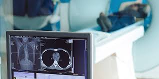 We did not find results for: Mri Technology Advancements What Do They Mean For You American Health Imaging