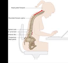 The long thoracic nerve may be injured during axillary dissection, trauma, or a thoracotomy. Levator Scapula Tension Why You Should Minimize Repetitive Overhead Arm Actions Stacy Dockins